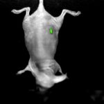 Fluorescence contrast (GFP)