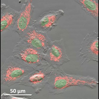 time-lapse: Human-lung-epithelial-cell-line 